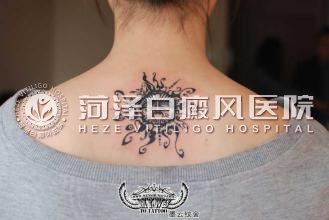 山东白癜风医院
