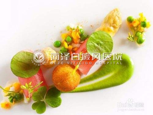 山东白癜风医院