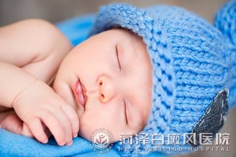 山东白癜风医院