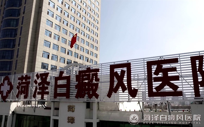 山东菏泽白癜风医院